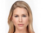 Botox® and Dysport®