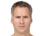 Botox® and Dysport®