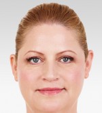 Dermal Fillers