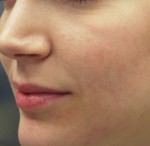 Fractora